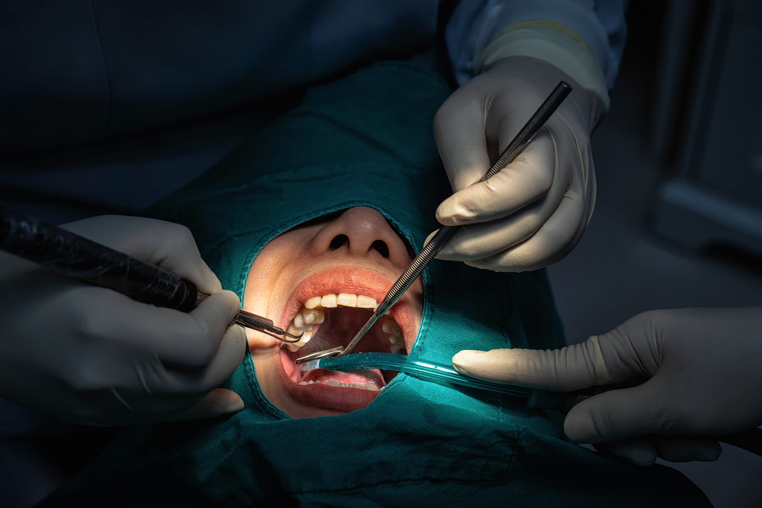 Antibioticoterapia em cirurgia oral quando indicar e quando evitar